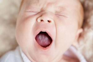 молочница симптомы у новорожденных во рту лечение