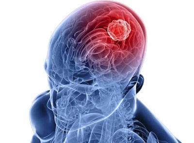 воспаление мозга симптомы и лечение