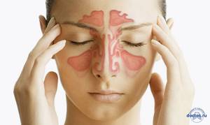 воспаление пазух носа симптомы лечение
