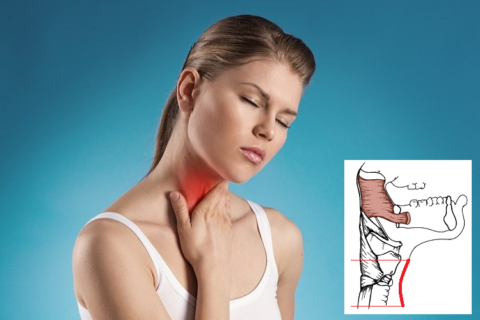 цервикалгия слева шейного отдела симптомы и лечение давит в горле