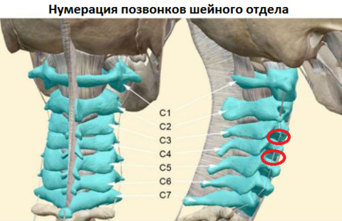 цервикалгия слева шейного отдела симптомы и лечение давит в горле