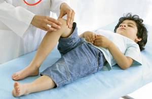 ревматизм у ребенка симптомы и лечение