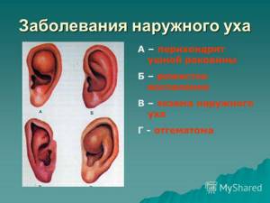 рожистое воспаление уха симптомы и лечение