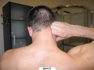 шейный остеохондроз симптомы и лечение дома массаж