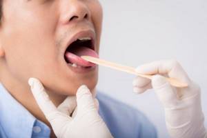 воспаление корня языка симптомы и лечение