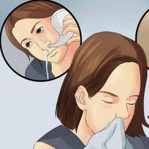 аденоидный кашель у ребенка симптомы и лечение