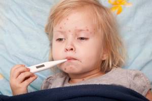 бактериальный вирус у ребенка симптомы и лечение
