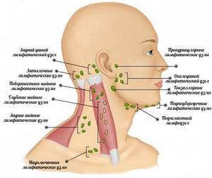 лимфоузлы на шее воспаление у ребенка симптомы и лечение