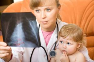 пневмония у годовалого ребенка симптомы и лечение