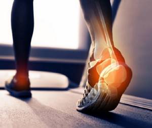 артрит ноги симптомы и лечение
