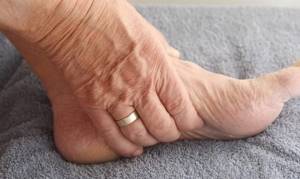 артроз стопы ноги симптомы и лечение в домашних условиях