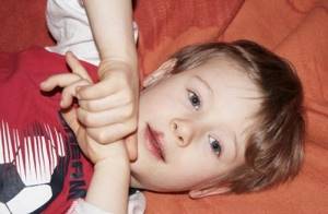 герпес на губах у ребенка 3 года симптомы и лечение
