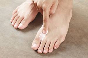 грибок кожи на ногах симптомы и лечение