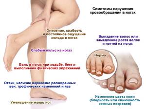 нарушение кровообращения в ногах симптомы лечение