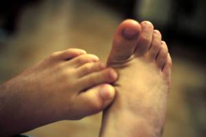 подворот ноги симптомы и лечение
