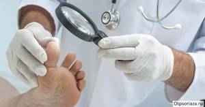псориаз ногтей на ногах симптомы лечение