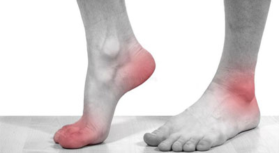 симптомы и лечение подагры на ногах