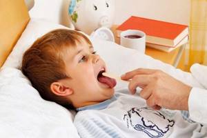 вирусная инфекция симптомы у детей лечение
