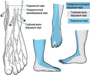 воспаление нерва ноги симптомы и лечение