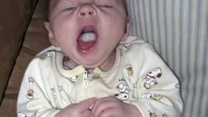 молочница у ребенка в 3 месяца симптомы и лечение