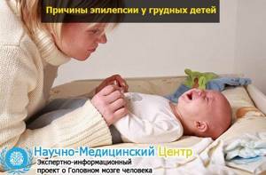 эпилепсия у младенцев симптомы лечение