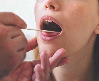 молочница полости рта у взрослых симптомы и лечение