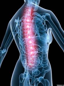 остеопороз симптомы и лечение шейного отдела