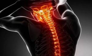 шейный грудной остеохондроз симптомы и лечение