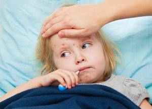 скарлатина симптомы и лечение у ребенка