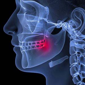 воспаление нижней челюсти симптомы и лечение