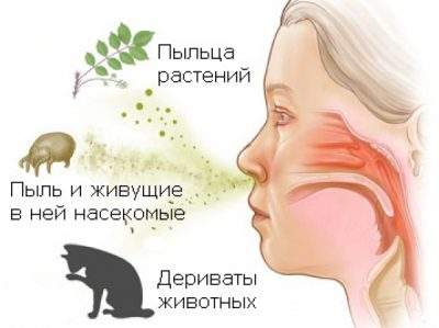 аллергический насморк у ребенка симптомы и лечение доктор комаровский