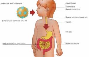 бактериальный вирус у ребенка симптомы и лечение