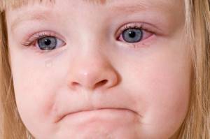 хронический конъюнктивит симптомы и лечение у ребенка