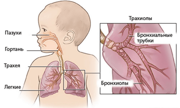 острый бронхит у ребенка 2 года симптомы и лечение