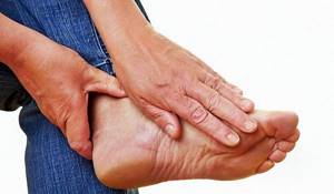 артроз второго пальца ноги симптомы лечение