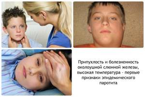детские болезни симптомы лечение