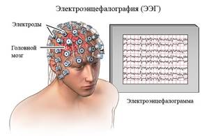 эпилепсия у детей симптомы причины лечение