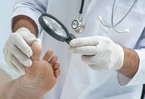 грибок на ногах между пальцами симптомы и лечение