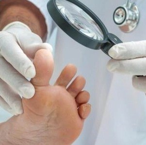 грибок на ногах симптомы и лечение мази