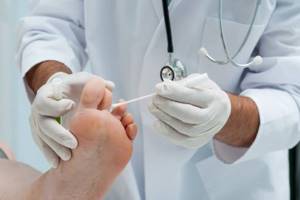 грибок ногтей на ногах начальная стадия симптомы и лечение
