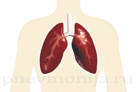 мелкоочаговая пневмония у детей симптомы лечение