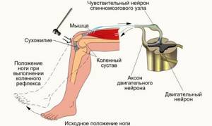 монопарез правой ноги симптомы и лечение