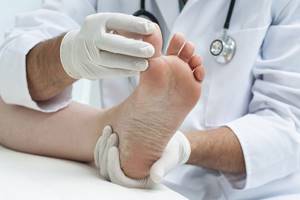 перелом на пальце ноги симптомы и лечение в домашних условиях