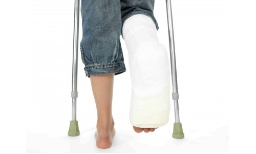 перелом ноги симптомы и лечение