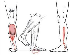 спазм икроножной мышцы одной ноги причины симптомы лечение и профилактика