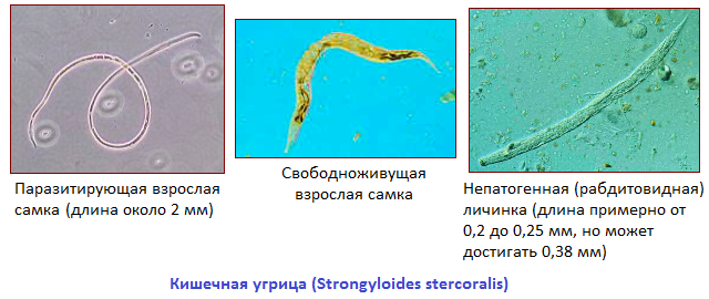 Жизненный цикл угрицы. Стронгилоидоз стеркоралис угрица. Личинки угрицы кишечной. Стронгилоид (кишечная угрица);. Гельминты кишечная угрица.