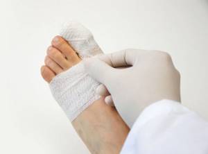 трещина в пальце ноги симптомы и лечение