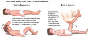 вирусный менингит симптомы у детей лечение