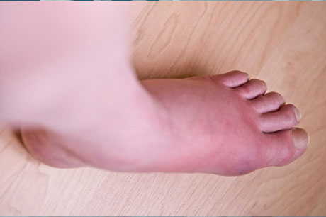 воспаление сустава ноги симптомы и лечение