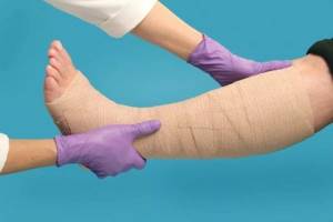 закупоренные сосуды на ногах симптомы и лечение